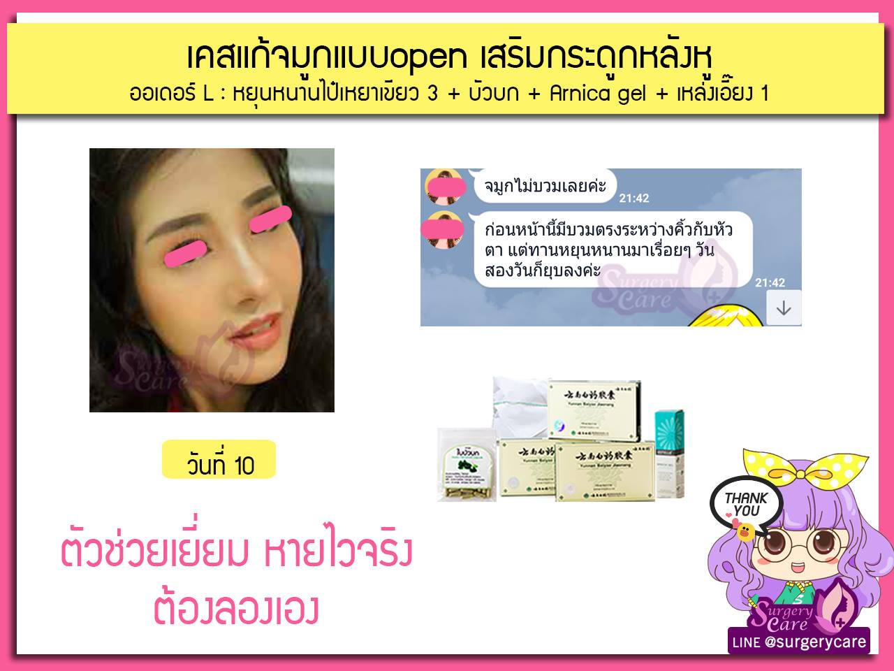 รีวิวเคสแก้จมูก ลูกค้าทานสมุนไพรหยุนหนานไป๋เหยากับเหล่งเอี๊ยงExtra