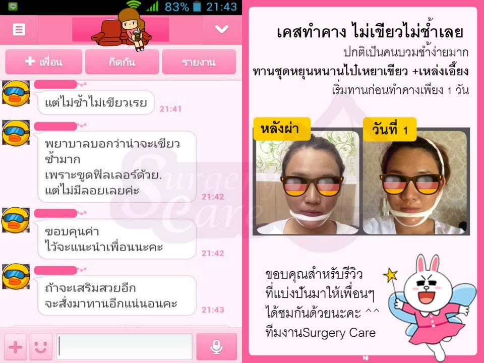 รีวิวทำคาง,เหล่งเอี้ยง, เหล่งเอี้ยงextra, สมุนไพรจีน, ยาลดบวมช้ำศัลยกรรม, ลดปวด, ลดอักเสบ, สมานแผล, ทำศัยกรรมอยากหายไว, เหล่งเอี้ยงของแท้, เหล่งเอี้ยง, เหล่งเอี้ยงextra, แผลหายไว, พักฟื้น, เขียวช้ำ, ลดบวมซ้ำ, ฟื้นตัว, หายไว, ยาลดบวม, รีวิวดูดไขมัน,รีวิวทำหน้าวีเชฟ,รีวิวทุบหน้า, หยุนหนานไป๋เหยา, หยุนหนานไป๋เหยากล่องเขียว, Yunnanpaiyao, สมุนไพรจีน, ยาลดบวมช้ำศัลยกรรม, ทำศัยกรรมอยากหายไว, หยุนหนานไป๋หยาของแท้, Surgerycare,
