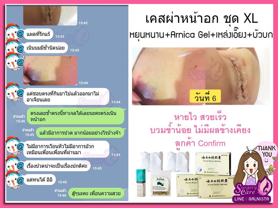 รีวิวทำหน้าอก รีวิวหยุนหนานไป๋เหยา เหล่งเอี๊ยงExtra