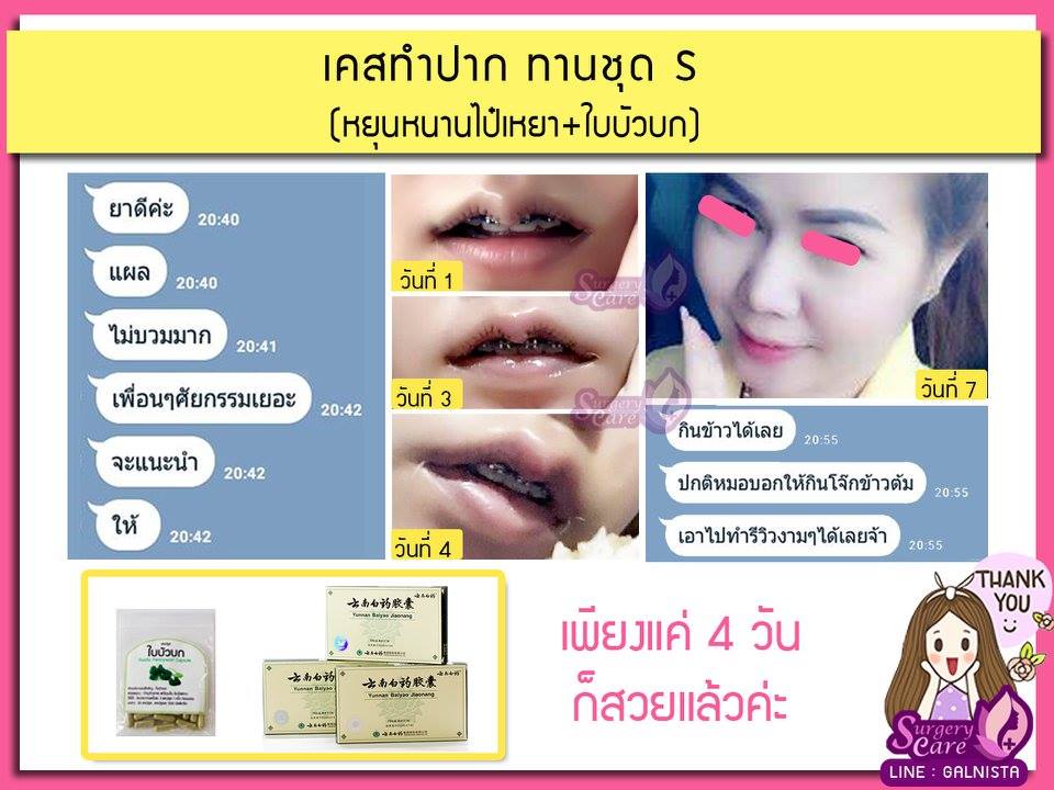 รีวิวทำปาก รีวิวหยุนหนานไป๋เหยา เหล่งเอี๊ยง