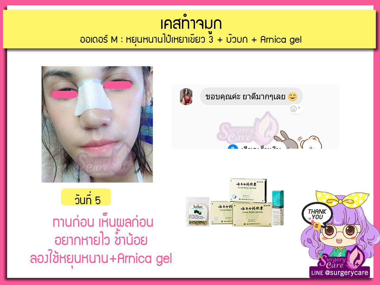 รีวิวแก้จมูก ลูกค้าทานสมุนไพรหยุนหนานไป๋เหยากับเหล่งเอี๊ยงExtra