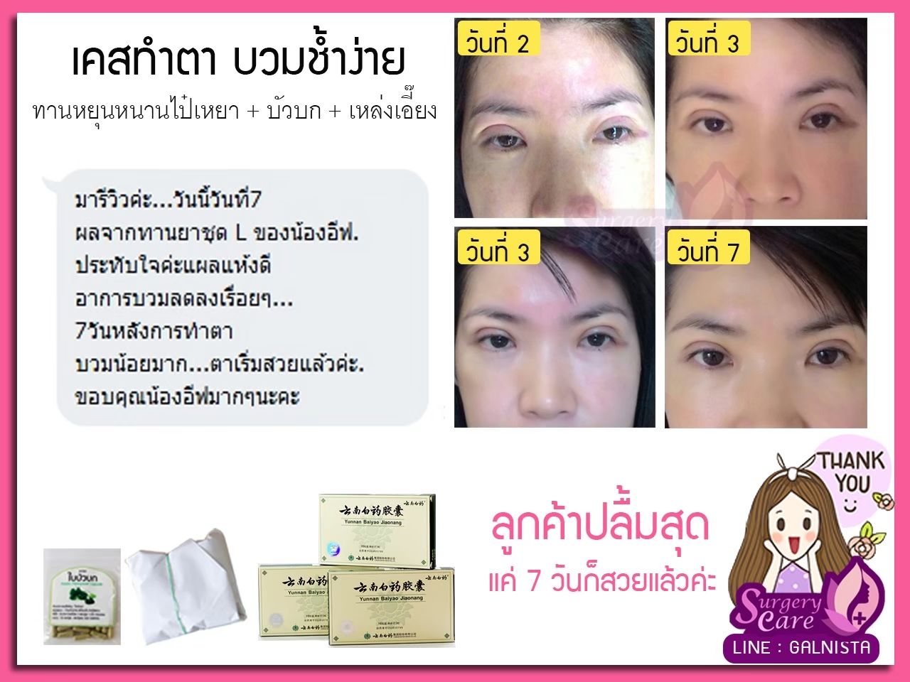 รีวิวทำตา ลูกค้าทานหยุนหนาไป๋เหยา เหล่งเอี๊ยง Extra