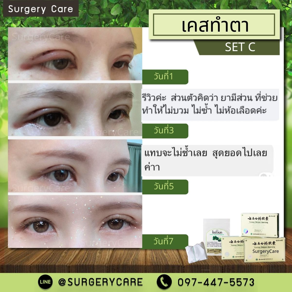 รีวิวทำตา ลูกค้าทานหยุนหนาไป๋เหยา เหล่งเอี๊ยง Extra2