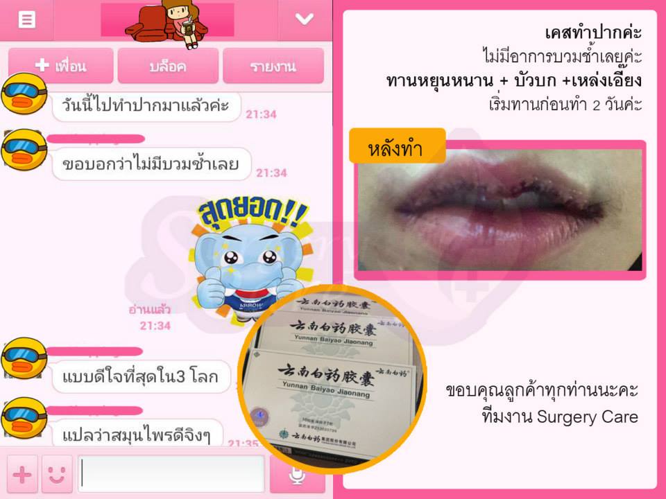 รีวิวทำปาก รีวิวหยุนหนานไป๋เหยา,รีวิวเหล่งเอี๊ยง,รีวิวสมุนไพร,รีวิวลดบวมช้ำ,รีวิวศัลยกรรม, รีวิวจมูก, รีวิวตา, รีวิวคาง , รีวิวเสริมหน้าอก, รีวิวดูดไขมัน, รีวิวศัลยกรรม, ฟิลเลอร์, ร้อยไหม, หยุนหนานไป๋เหยา ,Yunnanpaiyao, เหล่งเอี้ยงextra ,surgerycare, review, รีวิวผ่าตัด 