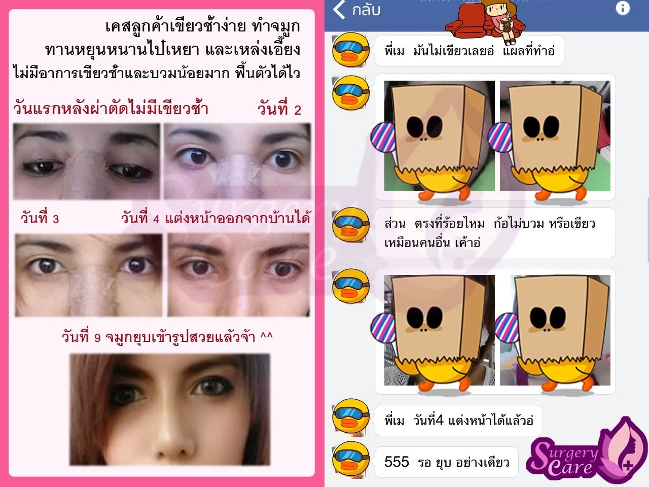 รีวิวทำจมูก รีวิวหยุนหนานไป๋เหยา เหล่งเอี๊ยงExtra