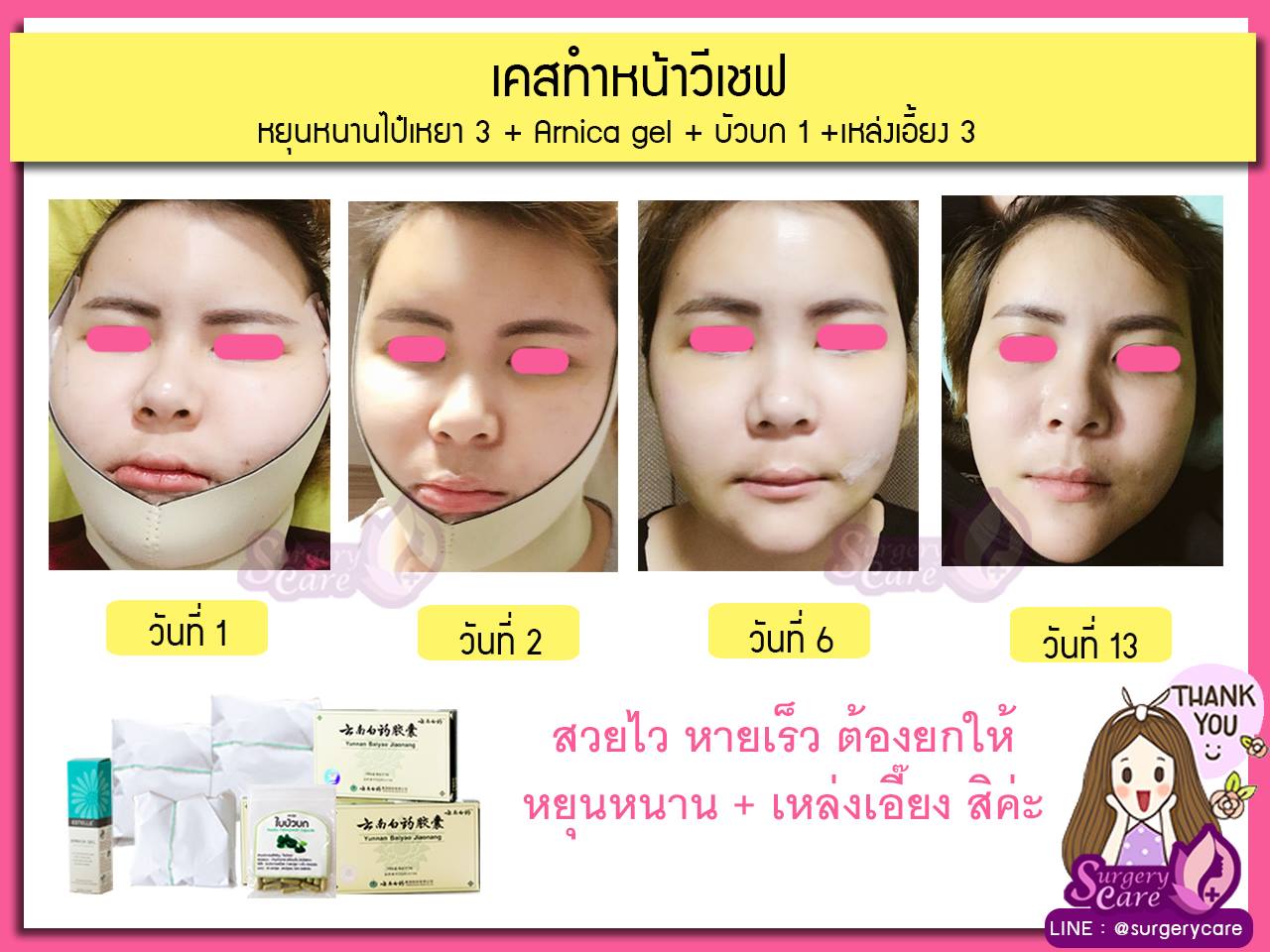 รีวิวทำหน้า V-Chef ทุบหน้าวีเชฟ