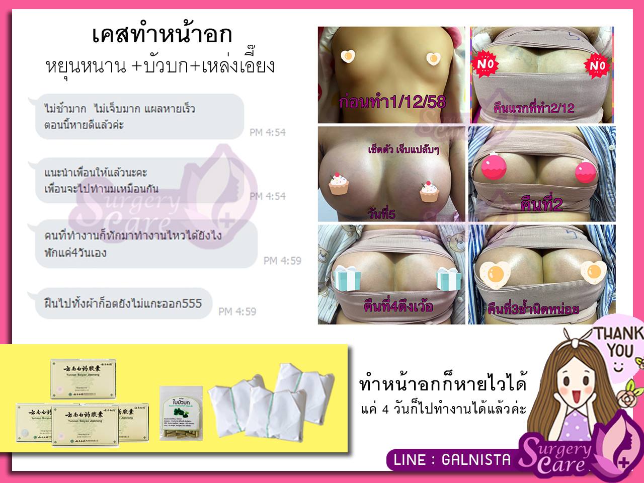 รีวิวทำหน้าอก รีวิวหยุนหนานไป๋เหยา เหล่งเอี๊ยงExtra
