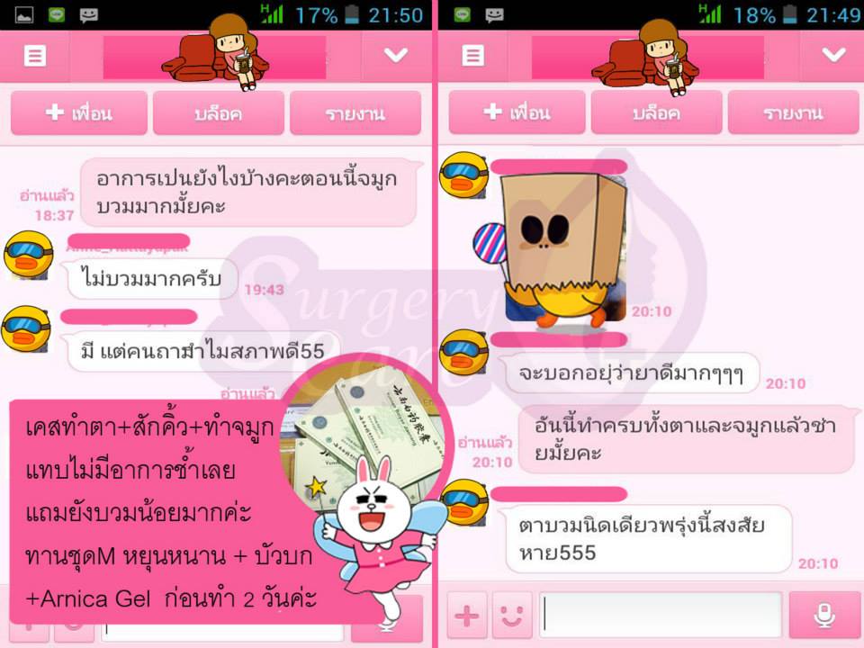 รีวิวทำตา,แก้ตา,ทำตา,ตา2ชั้น,รีวิวศัลยกรรมตา2ชั้น,รีวิวผ่าตา,รีวิวทำตา,รีวิวทำตาสองชั้น,รีวิวลดบวมช้ำ รีวิวศัลยกรรม,รีวิว, ศัลยกรรม, หยุนหนานไป๋เหยา, Yunnanpaiyao, เหล่งเอี้ยง, เหล่งเอี้ยงextra, surgerycare, review, รีวิวผ่าตัด