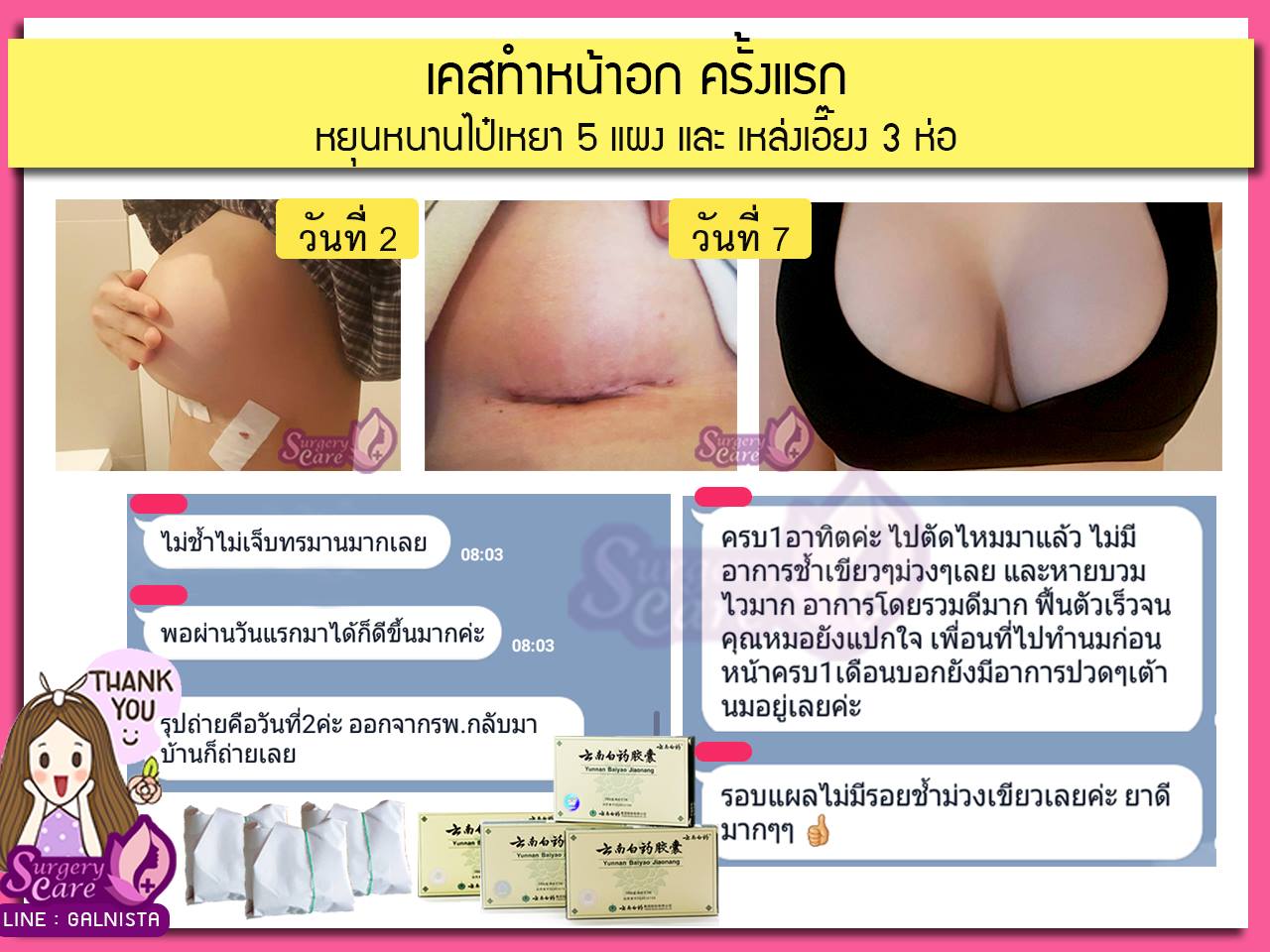 รีวิวทำหน้าอก รีวิวหยุนหนานไป๋เหยา เหล่งเอี๊ยงExtra
