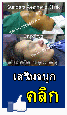 เสริมจมูก