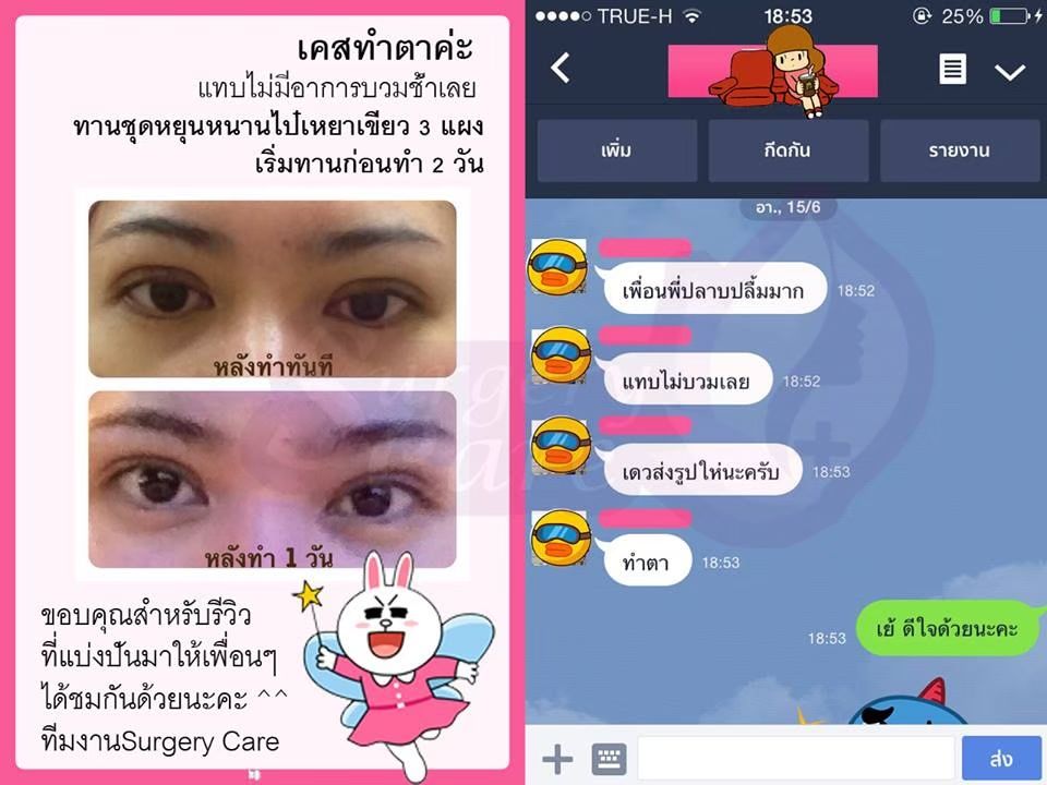 รีวิวทำตา ลูกค้าทานหยุนหนาไป๋เหยา เหล่งเอี๊ยง Extra