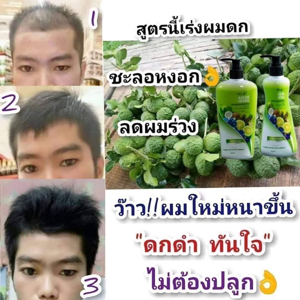 แชมพูสมุนไพรต้มสดเตาถ่าน สูตรมะกรูด สำหรับ หนังศรีษะมัน