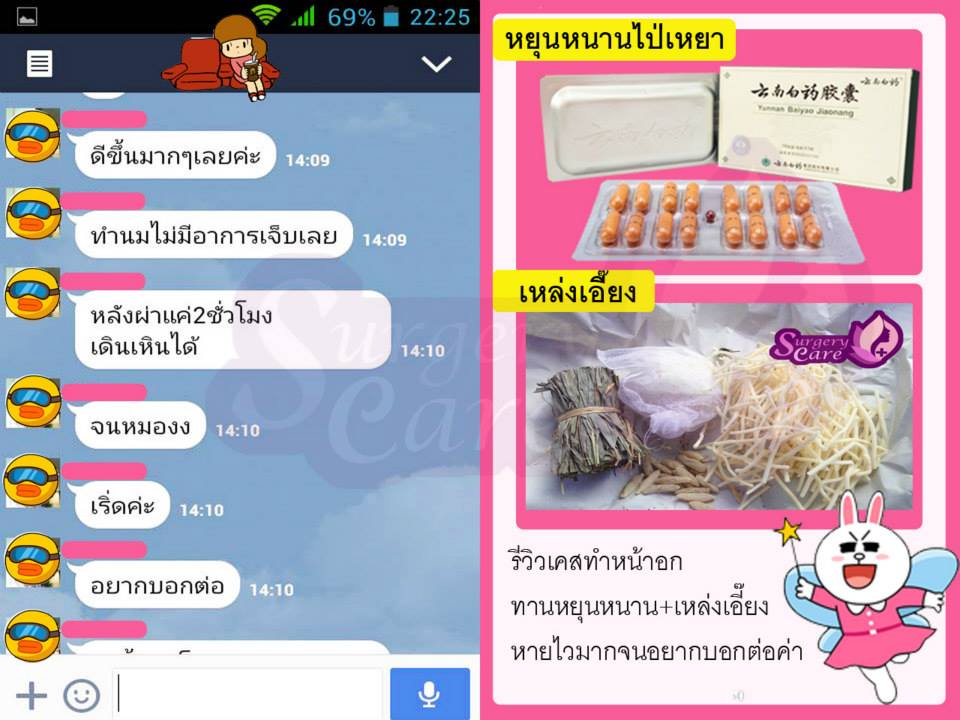 รีวิวทำหน้าอก,รีวิวเสริมหน้าอก,เหล่งเอี้ยง, เหล่งเอี้ยงextra, สมุนไพรจีน, ยาลดบวมช้ำศัลยกรรม, ลดปวด, ลดอักเสบ, สมานแผล, ทำศัยกรรมอยากหายไว, เหล่งเอี้ยงของแท้, เหล่งเอี้ยง, เหล่งเอี้ยงextra, แผลหายไว, พักฟื้น, เขียวช้ำ, ลดบวมซ้ำ, ฟื้นตัว, หายไว, ยาลดบวม, รีวิวดูดไขมัน,รีวิวทำหน้าวีเชฟ,รีวิวทุบหน้า, หยุนหนานไป๋เหยา, หยุนหนานไป๋เหยากล่องเขียว, Yunnanpaiyao, สมุนไพรจีน, ยาลดบวมช้ำศัลยกรรม, ทำศัยกรรมอยากหายไว, หยุนหนานไป๋หยาของแท้, Surgerycare,