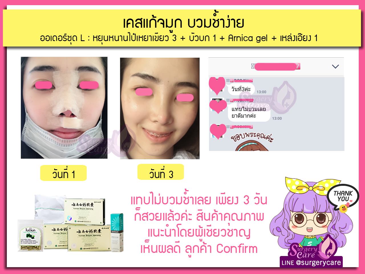 ทำจมูก,แก้จมูก,เสริมดั้ง,งัดดั้ง,รีวิวแก้จมูก, รีวิวแก้จมูกOpen, รีวิวแก้จมูกกระดูกอ่อนหลังหู,เหล่งเอี้ยง,เหล่งเอี้ยงextra ,สมุนไพรจีน,ยาลดบวมช้ำศัลยกรรม, ลดปวด, ลดอักเสบ, สมานแผล, ทำศัยกรรมอยากหายไว, เหล่งเอี้ยงของแท้, เหล่งเอี้ยง, เหล่งเอี้ยงextra, แผลหายไว, พักฟื้นน้อย, เขียวช้ำ, ลดบวมซ้ำ,ฟื้นตัวไว, หายไว, ยาลดบวม, หยุนหนานไป๋เหยา, หยุนหนานไป๋เหยากล่องเขียว, Yunnanpaiyao,สมุนไพรจีน, ยาลดบวมช้ำศัลยกรรม, ทำศัยกรรมอยากหายไว, หยุนหนานไป๋หยาของแท้, Surgerycare,