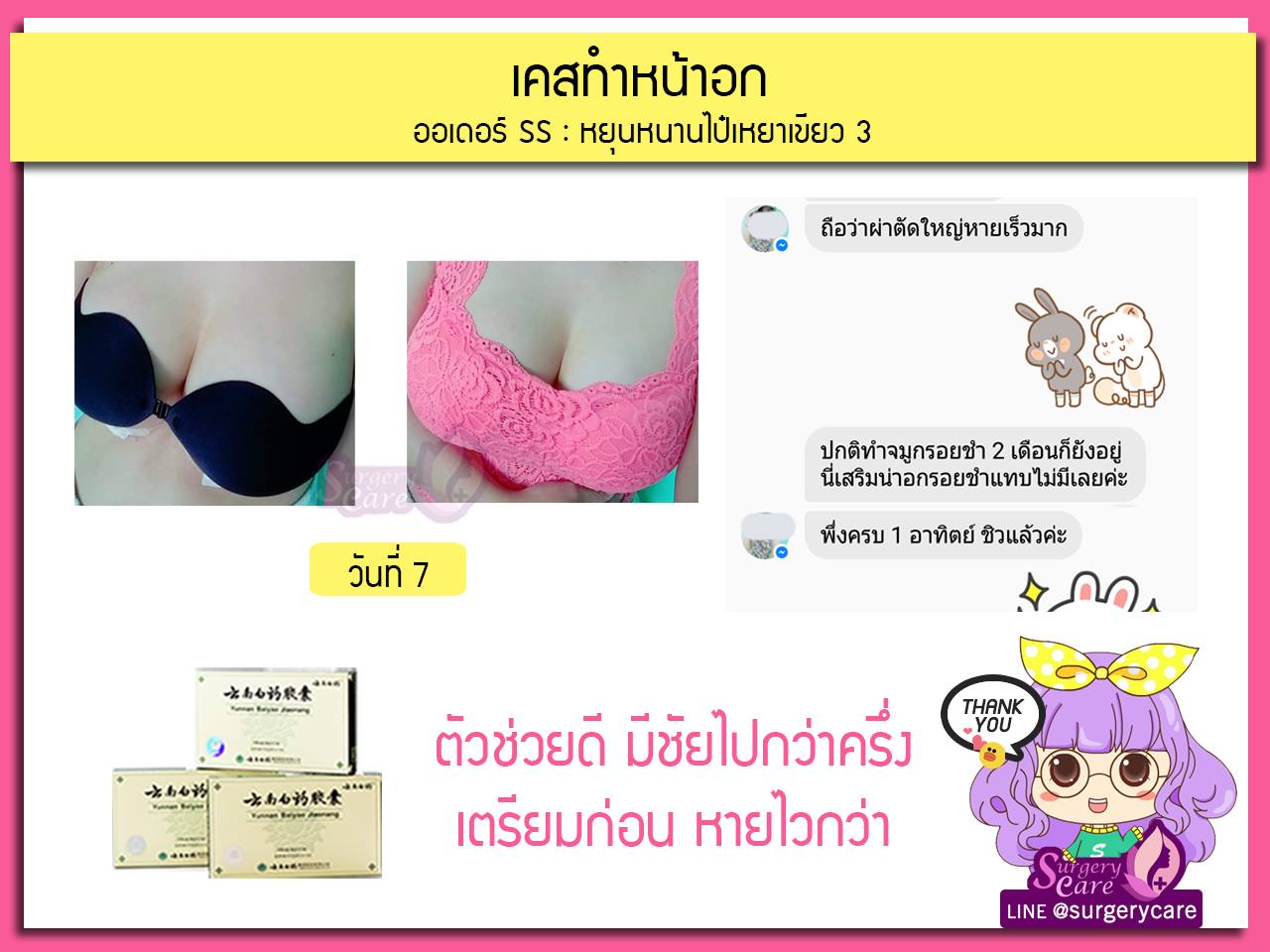 รีวิวเสริมหน้าอก,รีวิวทำนม,รีวิวหยุนหนานไป๋เหยา, รีวิวเหล่งเอี้ยง, รีวิวบัวบก, รีวิวสมุนไพร, รีวิวลดบวมช้ำ, รีวิวศัลยกรรม,รีวิว ศัลยกรรม, ฟิลเลอร์, ร้อยไหม, หยุนหนานไป๋เหยา, Yunnanpaiyao, เหล่งเอี้ยง, เหล่งเอี้ยงextra, surgerycare review ,รีวิวผ่าตัด , รีวิวเสริมหน้าอก,รีวิวทำนม,รีวิวหยุนหนานไป๋เหยา, รีวิวเหล่งเอี้ยง, รีวิวบัวบก, รีวิวสมุนไพร, รีวิวลดบวมช้ำ, รีวิวศัลยกรรม,รีวิว ศัลยกรรม, ฟิลเลอร์, ร้อยไหม, หยุนหนานไป๋เหยา, Yunnanpaiyao, เหล่งเอี้ยง, เหล่งเอี้ยงextra, surgerycare review ,รีวิวผ่าตัด ,