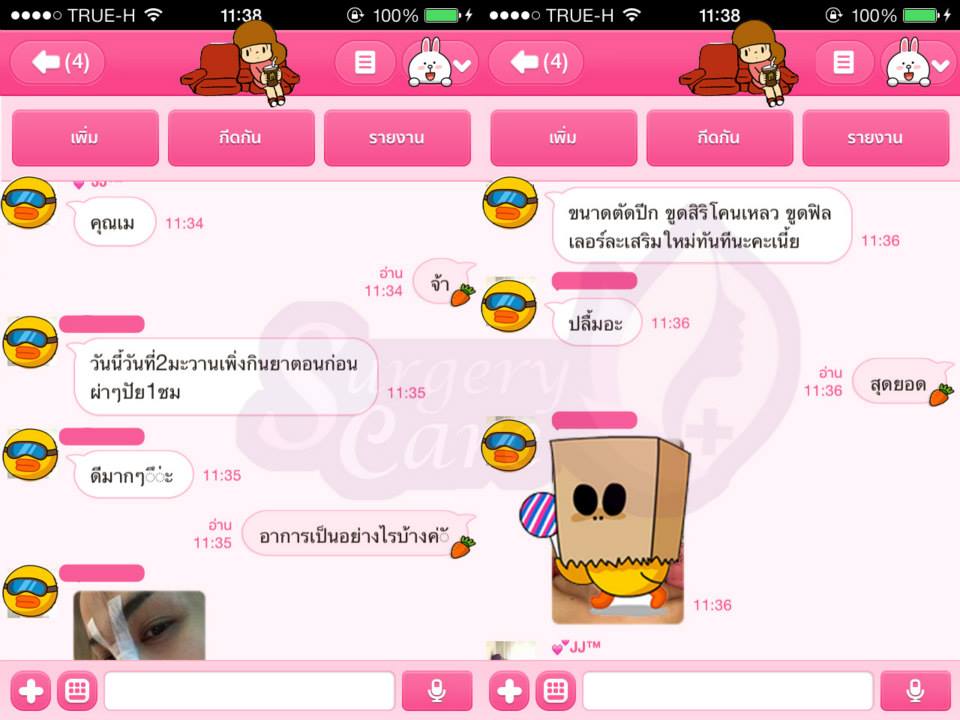 ตัดปีกจมูก,ขูดฟิลเลอร์,เสริมใหม่,ทุบดั้ง,งัดดั้ง,รีวิวิเคสแก้จมูก,ทำจมูก,เสริมจมูก,แก้จมูก,รีวิวจมูก,รีวิวแก้จมูก,รีวิวเสริมจมูก,เหล่งเอี้ยง, เหล่งเอี้ยงextra, สมุนไพรจีน, ยาลดบวมช้ำศัลยกรรม, ลดปวด, ลดอักเสบ, สมานแผล, ทำศัยกรรมอยากหายไว, เหล่งเอี้ยงของแท้, เหล่งเอี้ยง, เหล่งเอี้ยงextra, แผลหายไว, พักฟื้น, เขียวช้ำ, ลดบวมซ้ำ, ฟื้นตัว, หายไว, ยาลดบวม, รีวิวดูดไขมัน,รีวิวทำหน้าวีเชฟ,รีวิวทุบหน้า, หยุนหนานไป๋เหยา, หยุนหนานไป๋เหยากล่องเขียว, Yunnanpaiyao, สมุนไพรจีน, ยาลดบวมช้ำศัลยกรรม, ทำศัยกรรมอยากหายไว, หยุนหนานไป๋หยาของแท้, Surgerycare,