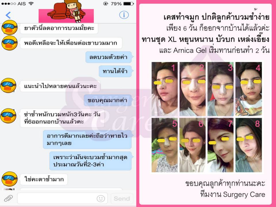 รีวิวหยุนหนานไป๋เหยา Review Yunnanpaiyao 1