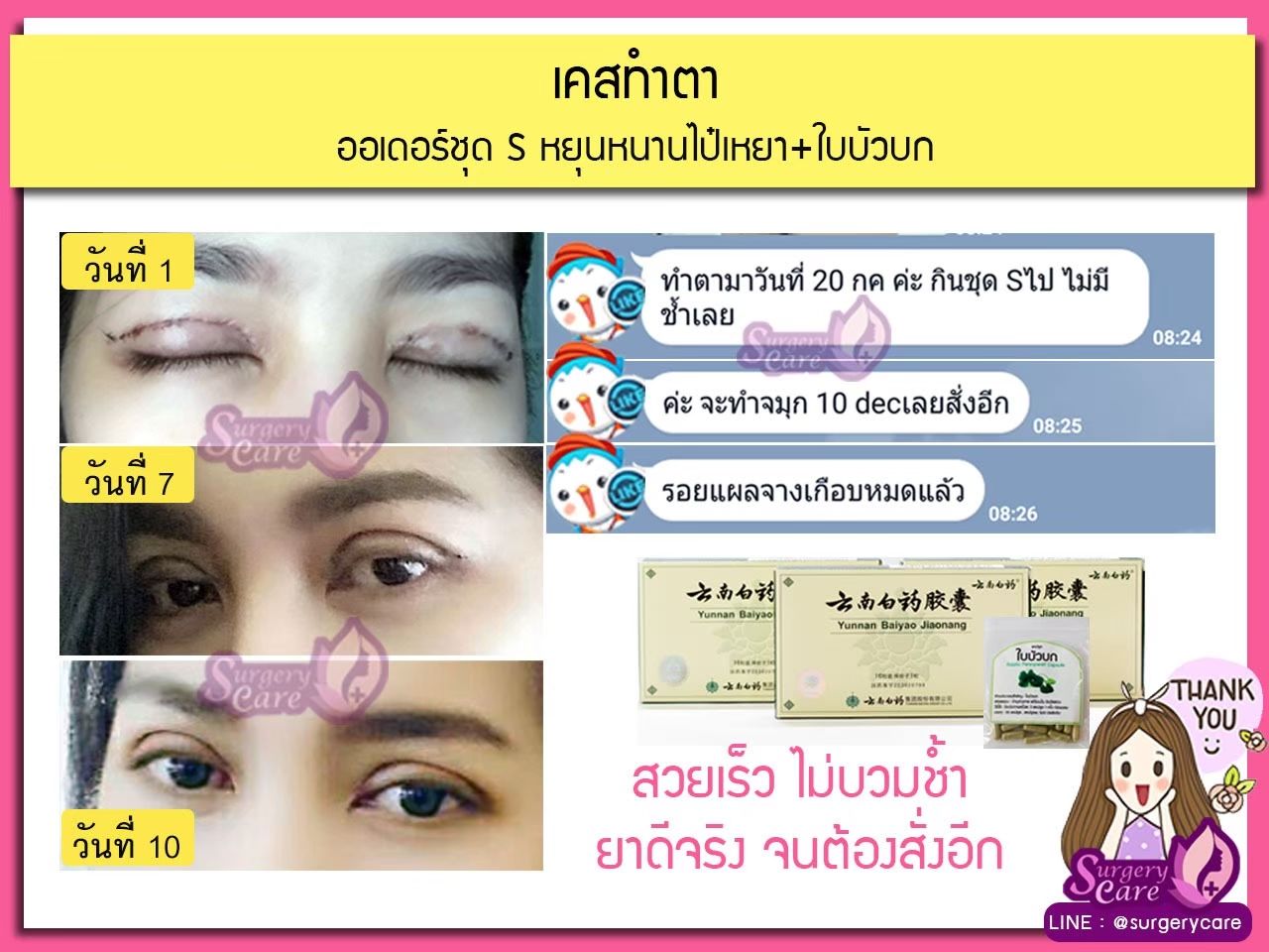 รีวิวทำตา ลูกค้าทานหยุนหนาไป๋เหยา เหล่งเอี๊ยง Extra