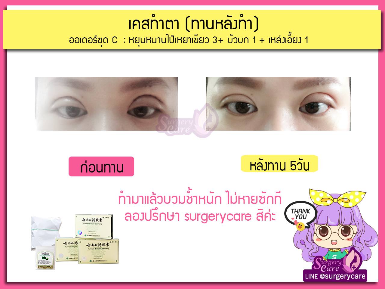 รีวิวทานหลังผ่ามาแล้วบวมช้ำน้อยหายไว