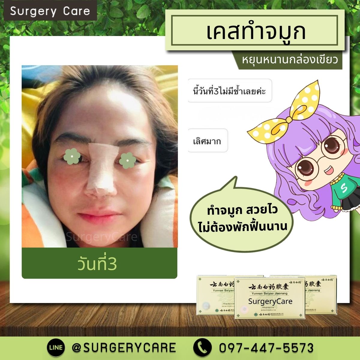 #หยุนหนานไป๋เหยา #Yunnanpaiyao #สมุนไพรจีน #ยาลดบวมช้ำศัลยกรรม #ลดปวด #ลดอักเสบ #สมานแผล #ศัลยกรรม #หายไว #แผลหายไว #พักฟื้น #เขียวช้ำ #ลดบวมซ้ำ #ฟื้นตัว #หายไว #ยาลดบวม #Surgerycare #จมูก #ตา #คาง #ปาก #หน้าอก #ดูดไขมัน