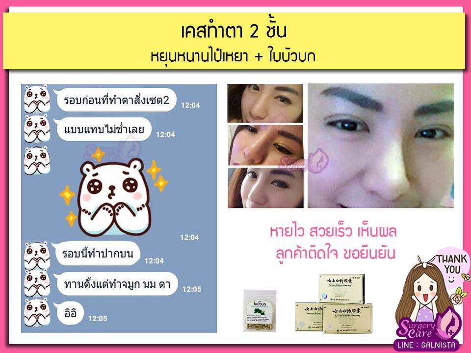 รีวิวทำตา ลูกค้าทานหยุนหนาไป๋เหยา เหล่งเอี๊ยง Extra บัวบก