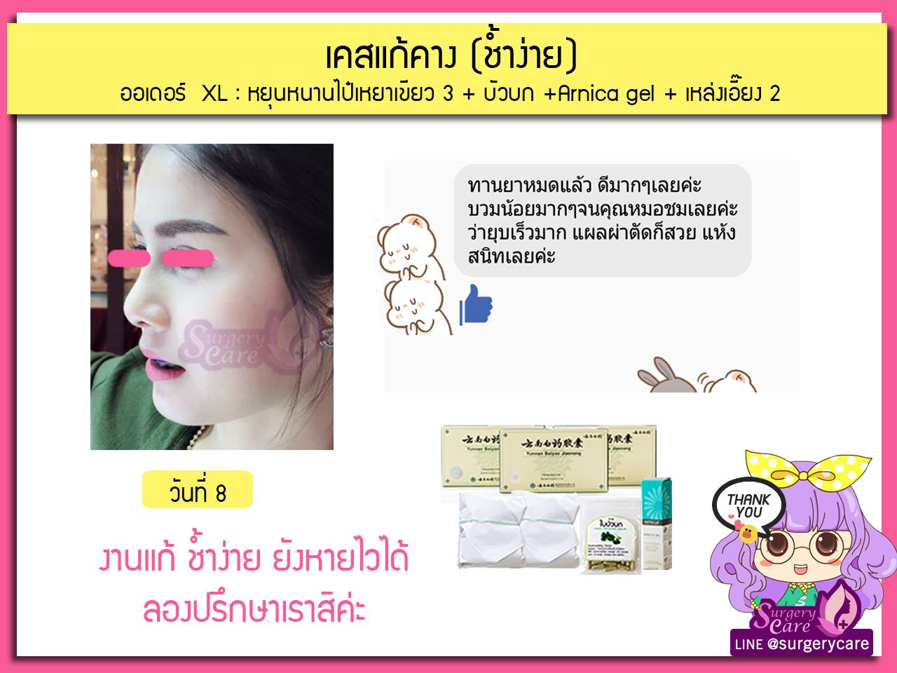 รีวิวเคสแก้จมูก ลูกค้าทานสมุนไพรหยุนหนานไป๋เหยากับเหล่งเอี๊ยงExtra