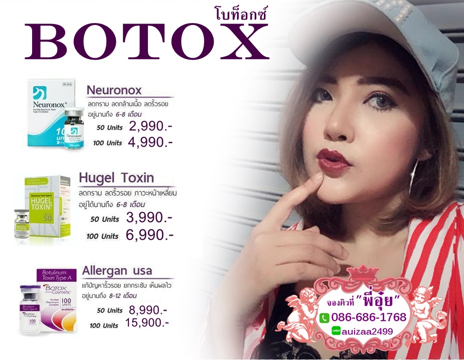 โบท็อกซ์ Botox
