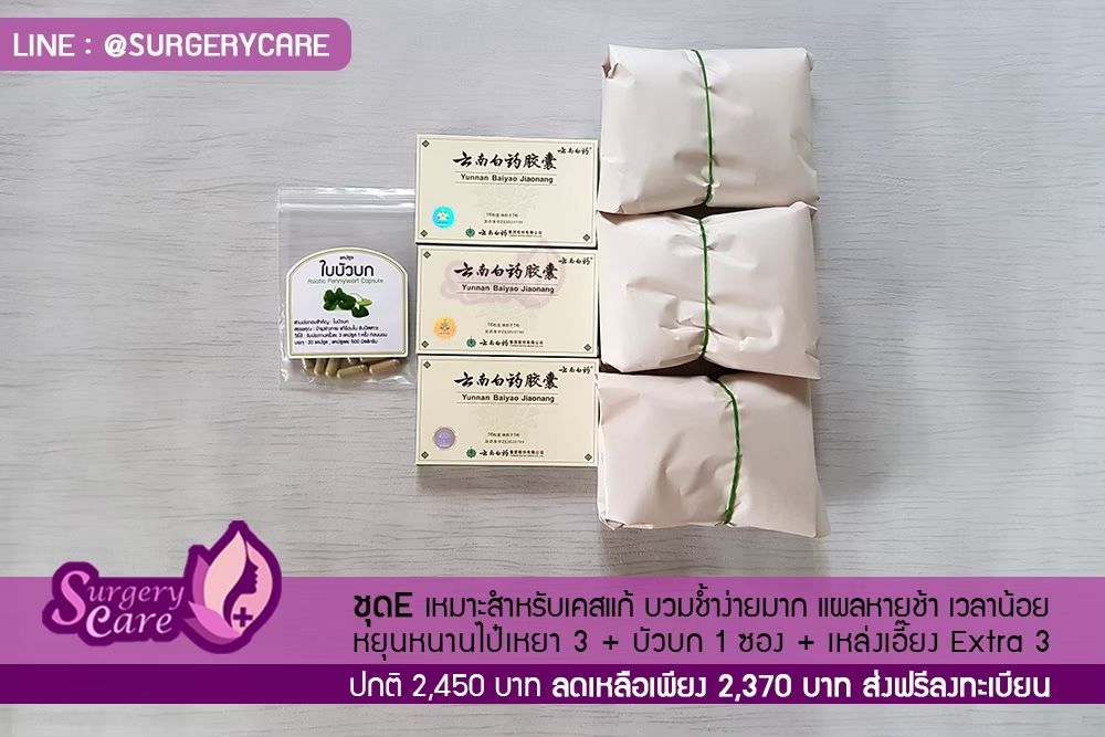 ฉีดไขมัน,เติมไขมัน,ฉีดไขมันหน้าเด็ก,หยุนหนานไป๋เหยา,Yunnanpaiyao,สมุนไพรจีน,เหล่งเอี๊ยงextra,ยาลดบวมช้ำศัลยกรรม,ลดปวด,ลดอักเสบ,สมานแผล,ศัลยกรรม,หายไว,แผลหายไว,พักฟื้น,เขียวช้ำ,ลดบวมซ้ำ,ฟื้นตัวหายไว,ยาลดบวม,Surgerycare,จมูก,ตา,คาง,ปาก,หน้าอก,ดูดไขมัน ,ทำหน้า ,ผ่าตัด ,ของแท้