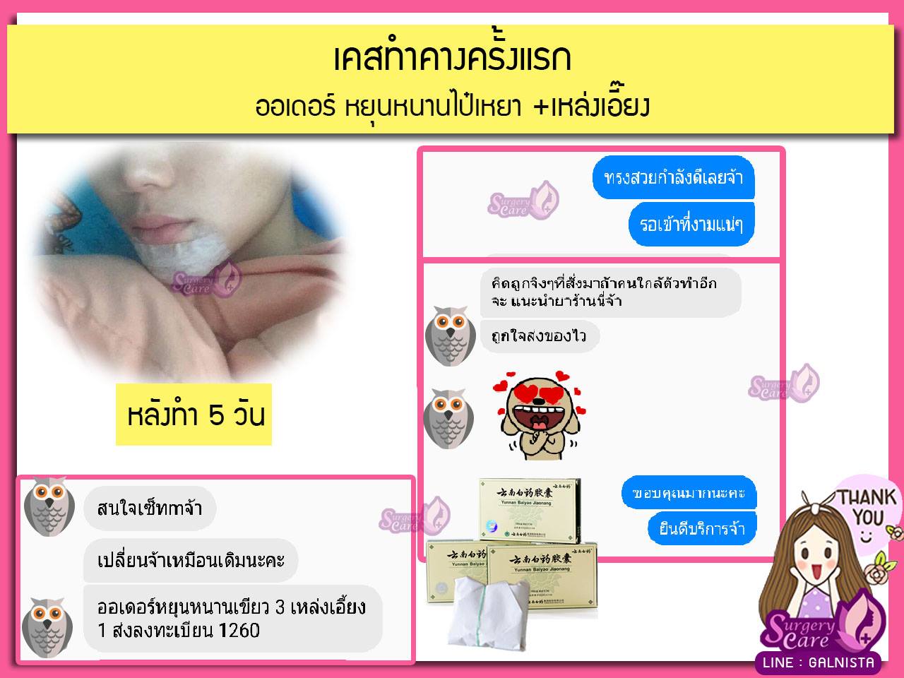 รีวิวทำคาง,รีวิวเสริมคาง,เหล่งเอี้ยง, เหล่งเอี้ยงextra, สมุนไพรจีน, ยาลดบวมช้ำศัลยกรรม, ลดปวด, ลดอักเสบ, สมานแผล, ทำศัยกรรมอยากหายไว, เหล่งเอี้ยงของแท้ ,เหล่งเอี้ยง, เหล่งเอี้ยงextra, แผลหายไว, พักฟื้น, เขียวช้ำ, ลดบวมซ้ำ, ฟื้นตัว, หายไว, ยาลดบวม, หยุนหนานไป๋เหยา, หยุนหนานไป๋เหยากล่องเขียว, Yunnanpaiyao, สมุนไพรจีน, ยาลดบวมช้ำ,ศัลยกรรม, ทำศัยกรรมอยากหายไว, หยุนหนานไป๋หยาของแท้, Surgerycare,