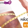 การดูแลตัวเองหลังดูดไขมัน