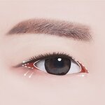 ศัลยกรรมตา ยังไงให้สวยไวทันใจ