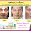 รีวิวแก้จมูก ลูกค้าทานสมุนไพรหยุนหนานไป๋เหยากับเหล่งเอี๊ยงExtra