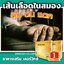 เคอร์วิกซ์ kervix