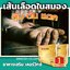 เคอร์วิกซ์ kervix