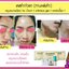 รีวิวทานหลังผ่าศัลยกรรม ผ่ามาแล้วบวมเขียวช้ำหายไว
